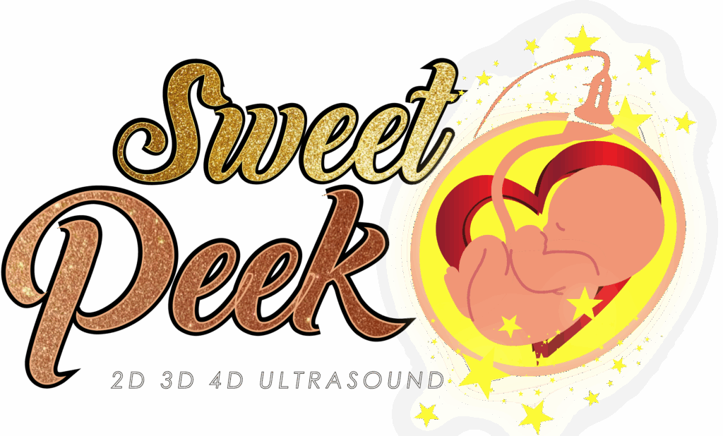 Sweet Peek LLC | Mobile 3D/4D/HD Ultrasound in Dallas,TX