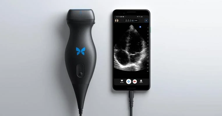 Sweet Peek LLC | Mobile 3D/4D/HD Ultrasound in Dallas,TX